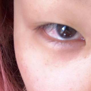 EuroEyez